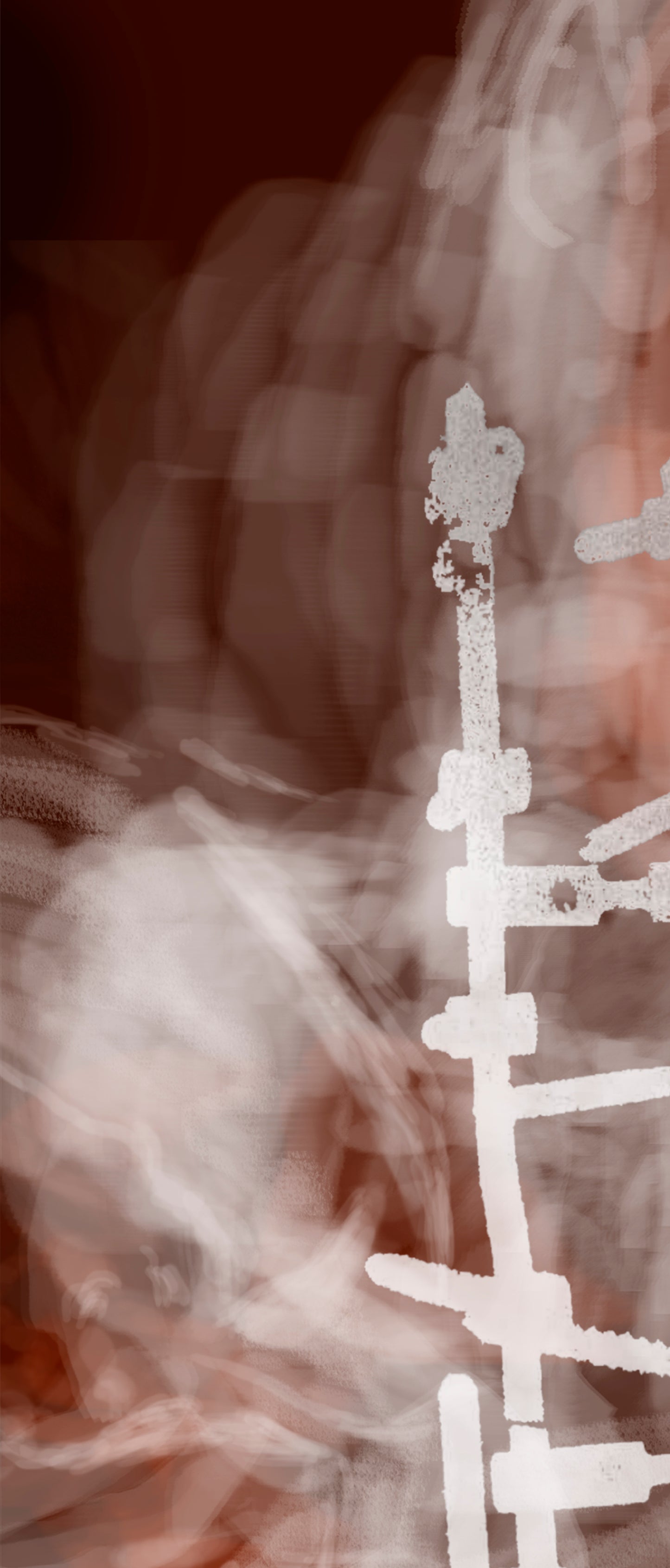 Prótesis de espina dorsal estudio 7