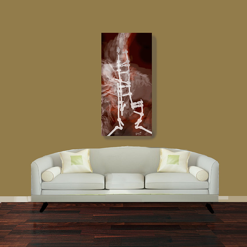 Prótesis de espina dorsal estudio 7