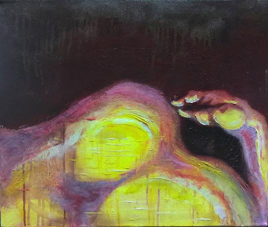 Interferón Beta 1-a