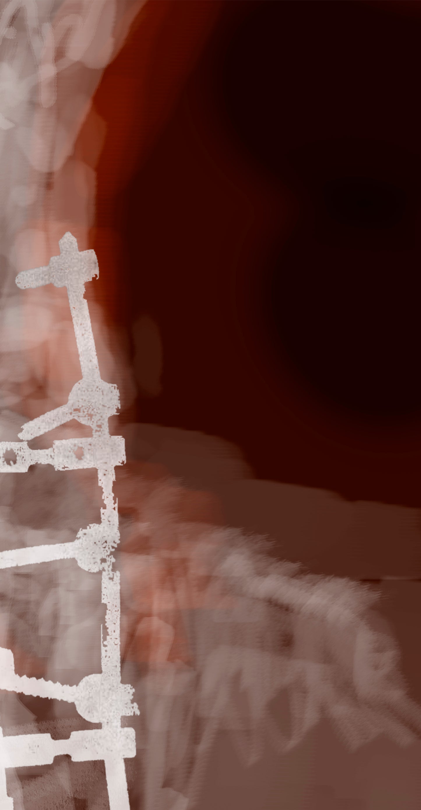 Prótesis de espina dorsal estudio 7