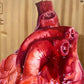 Cardiectomía