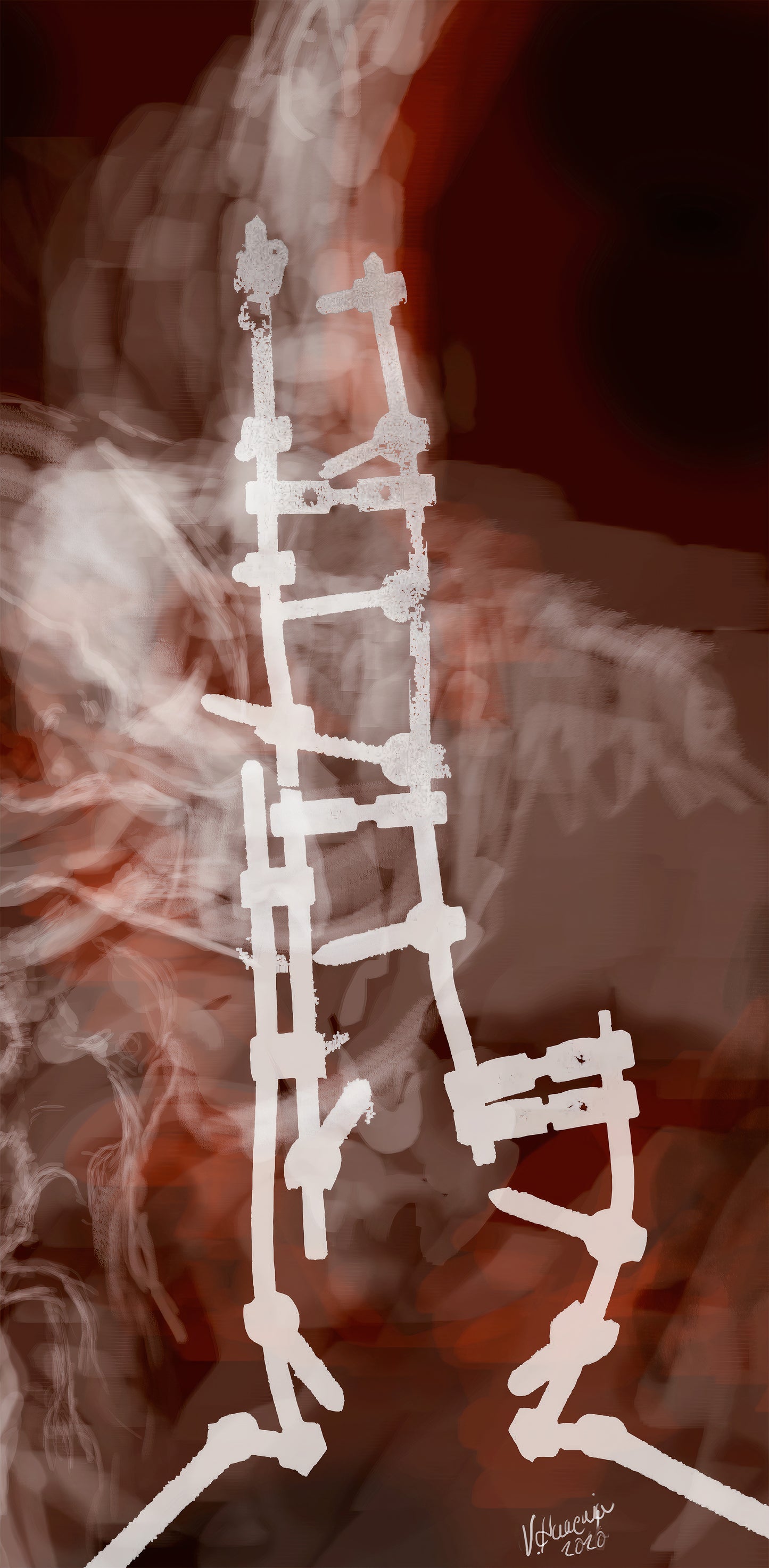 Prótesis de espina dorsal estudio 7